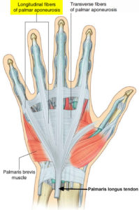 Dupuytren's Contracture - Causes, Symptoms, Treatment