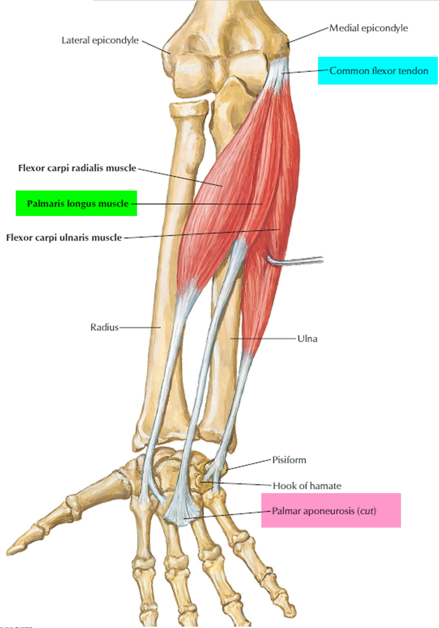 Dupuytren s Contracture Causes Symptoms Treatment