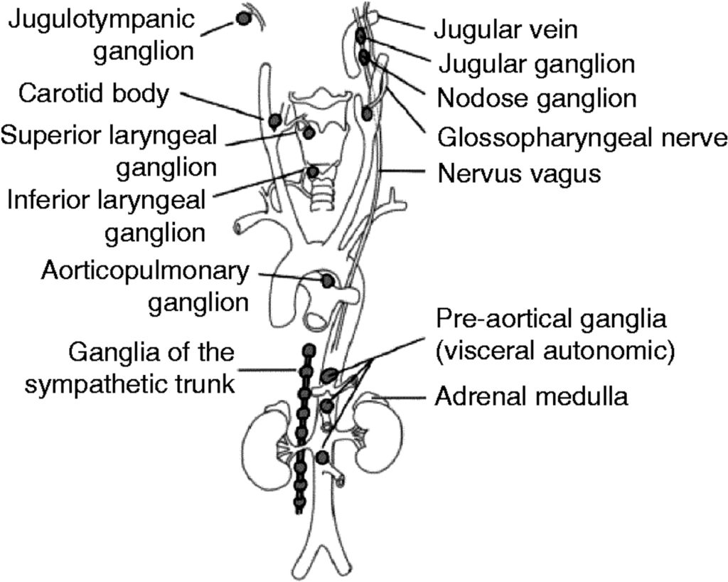 Paraganglioma Tumor Causes, Symptoms, Diagnosis, Treatment