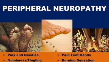 peripheral neuropathy