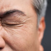 postherpetic neuralgia