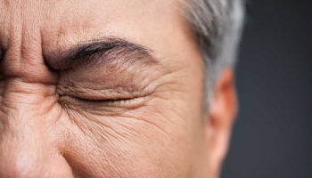 postherpetic neuralgia