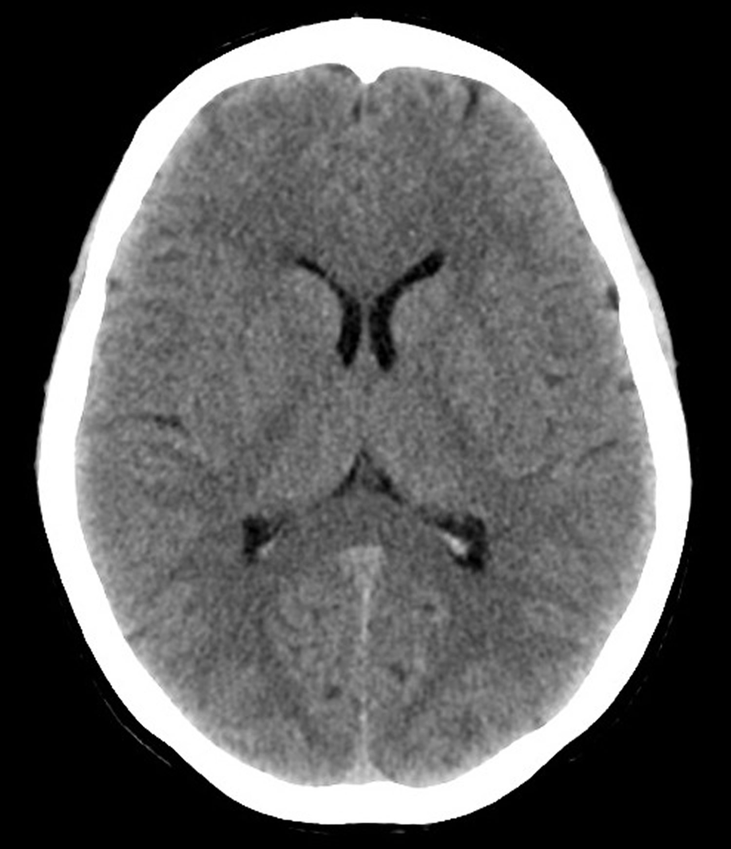 Mechanism Of Ct Scan