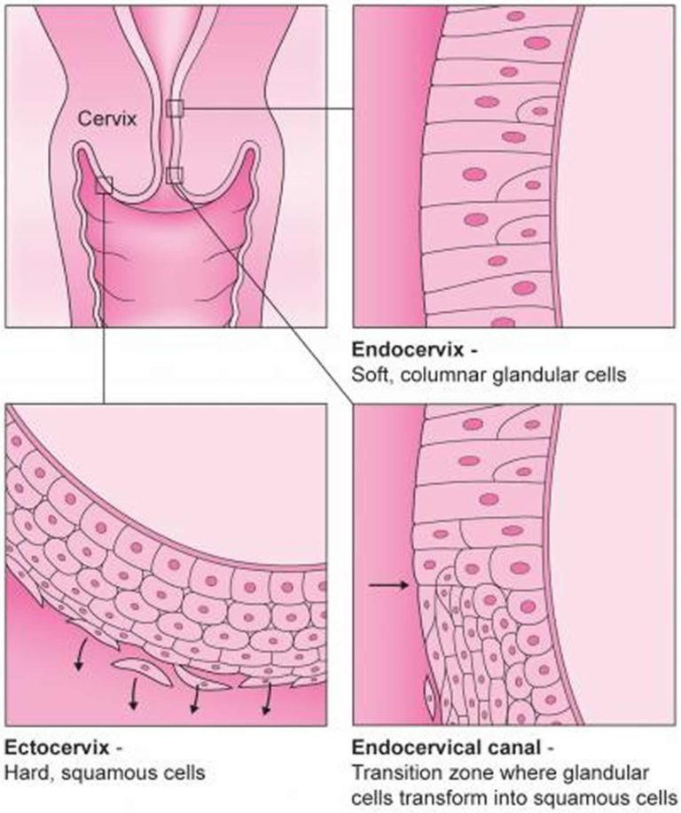 Colposcopy Colposcopy Biopsy Results Hpv Side Effects 