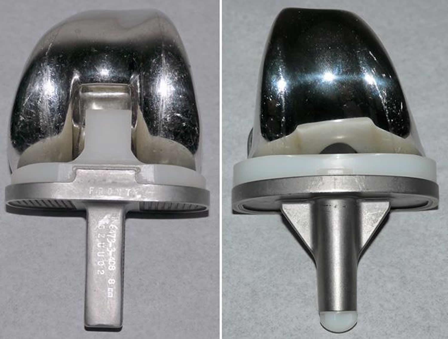 Different types of knee implants