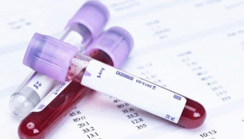 MCV blood test