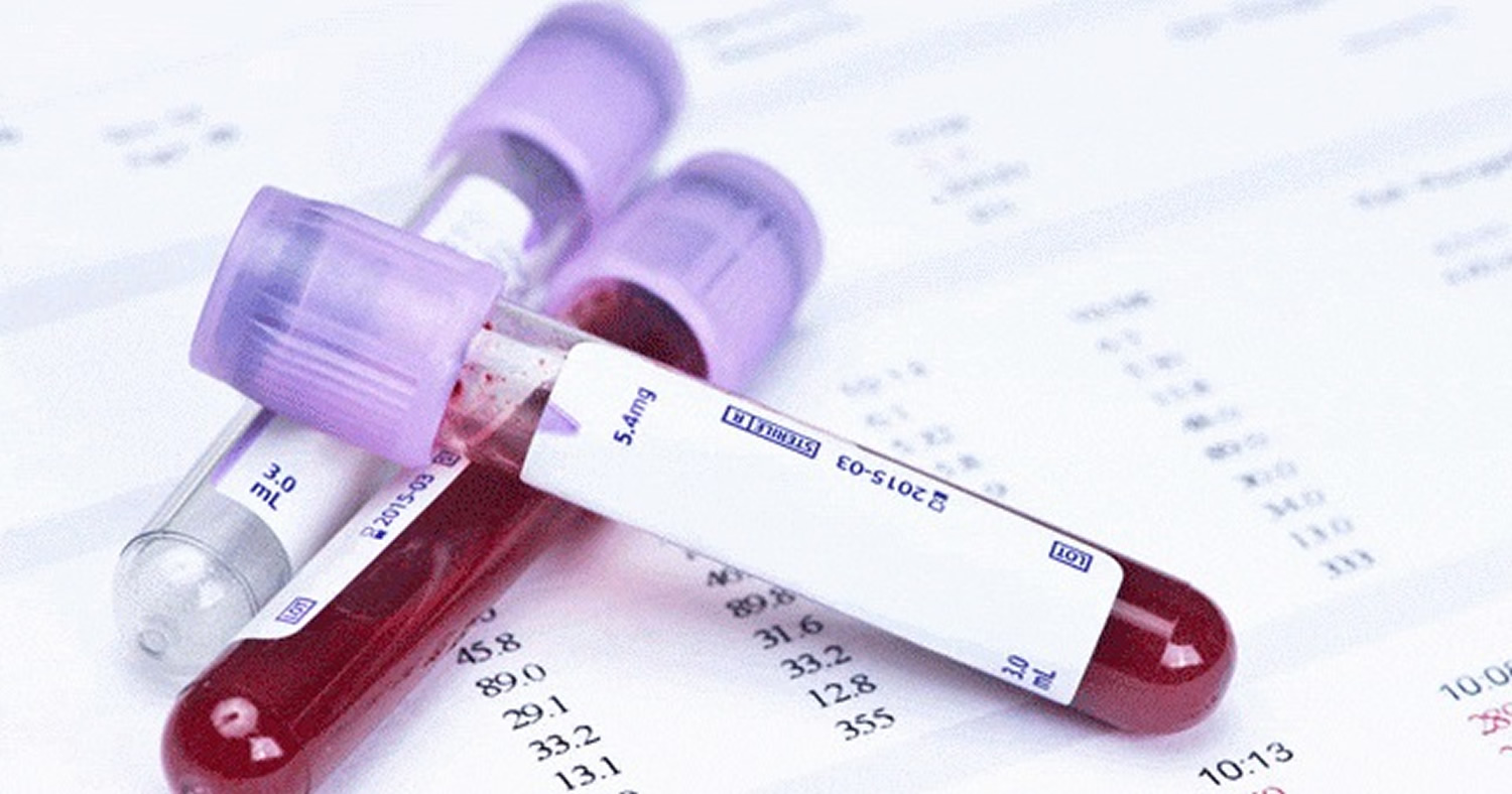 What Does Elevated Mcv Mean In A Blood Test