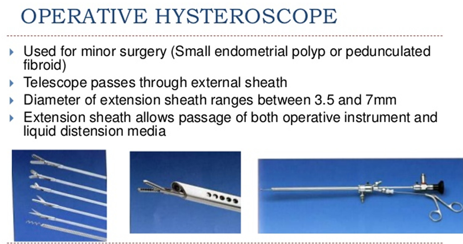 Hysteroscopy - Hysteroscopy D & C, Recovery & Side Effects