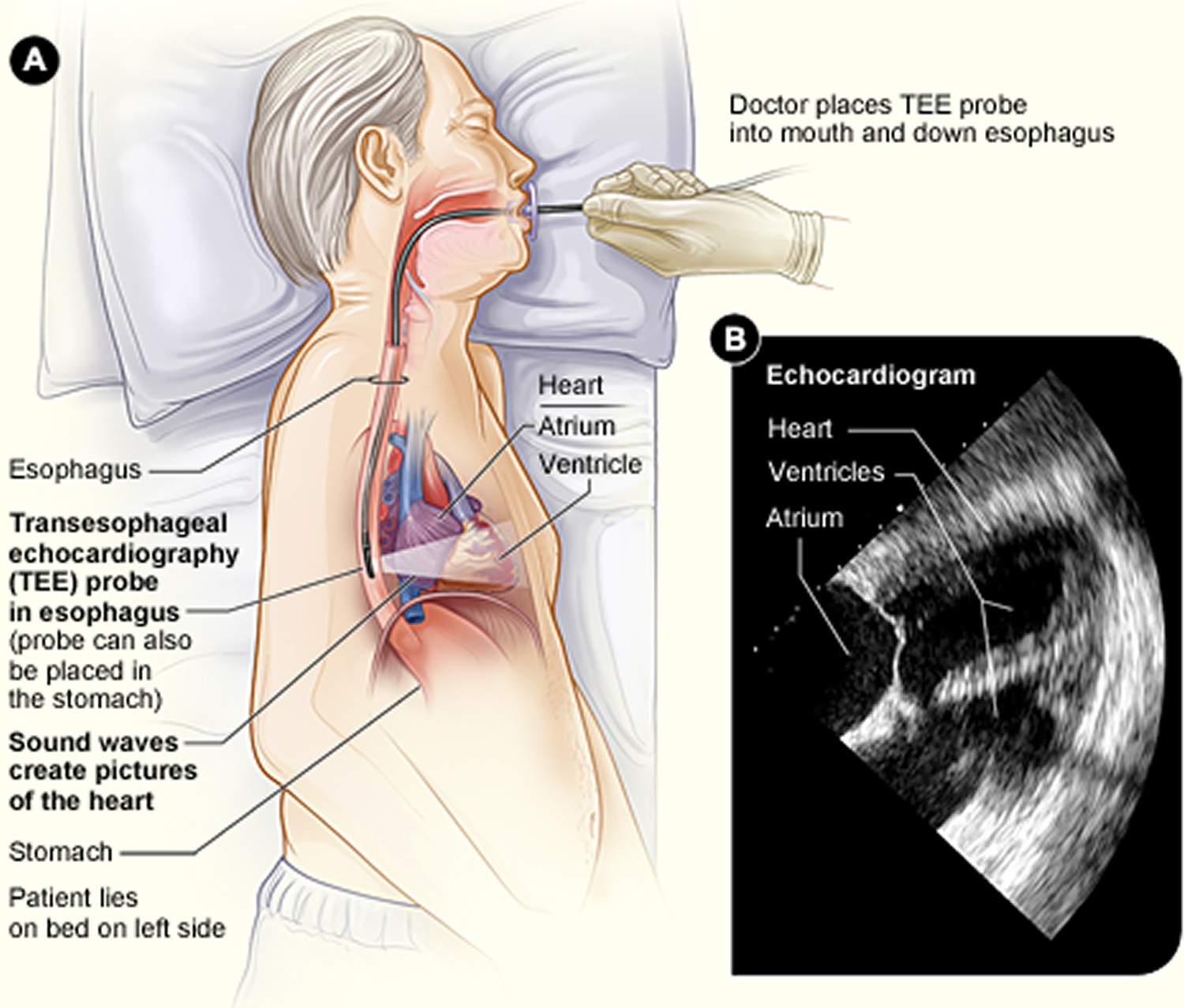 Echocardiogram Transesophageal Transthoracic Stress Echocardiogram