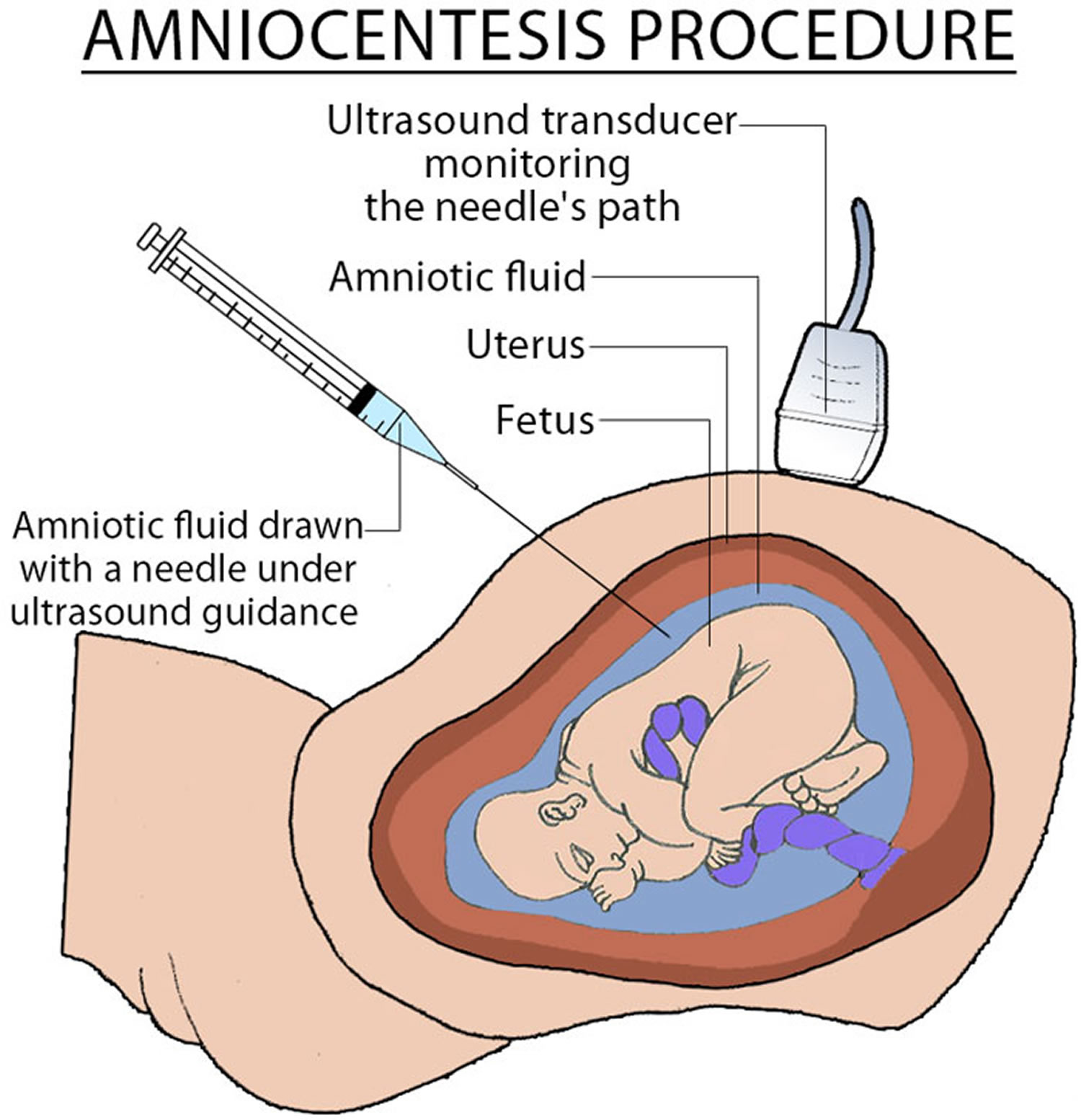 Tax lien investing risks of amniocentesis financial sound