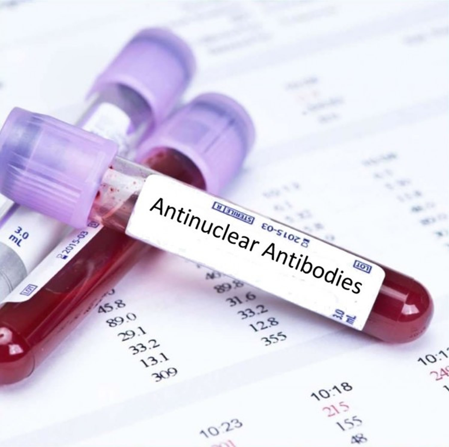 Antinuclear Antibody - Test and Positive ANA Symptoms