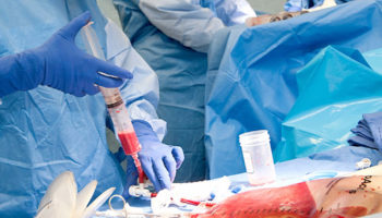 bone_marrow_transplant