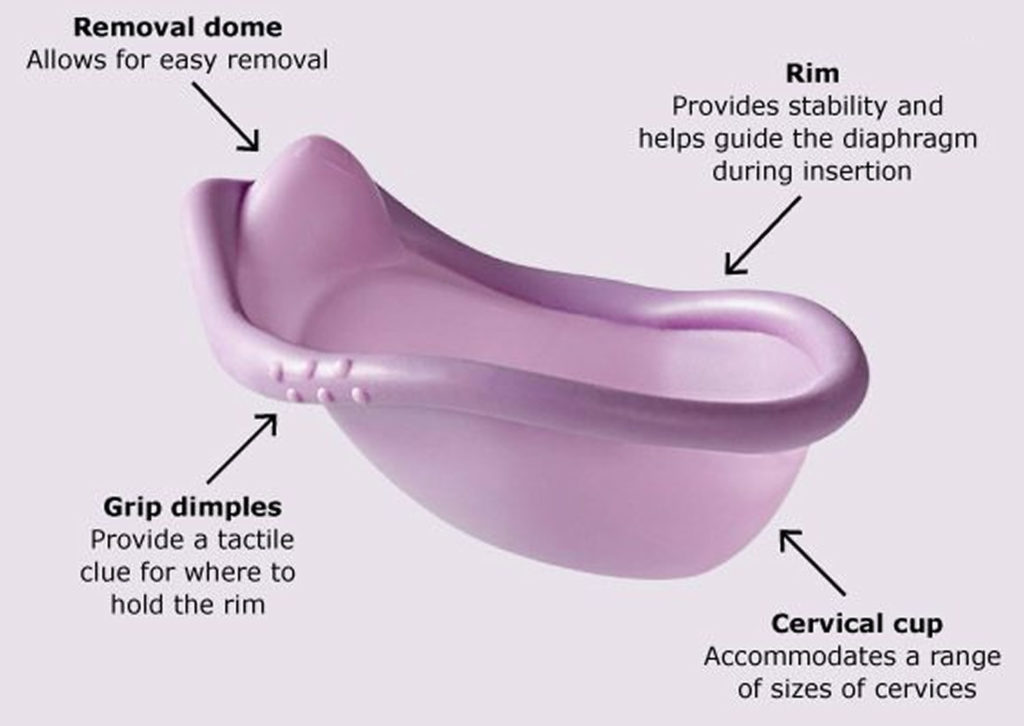 Diaphragm birth control how does a diaphragm work and effectiveness