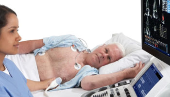 echocardiogram