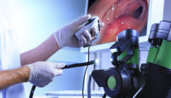 endoscopy