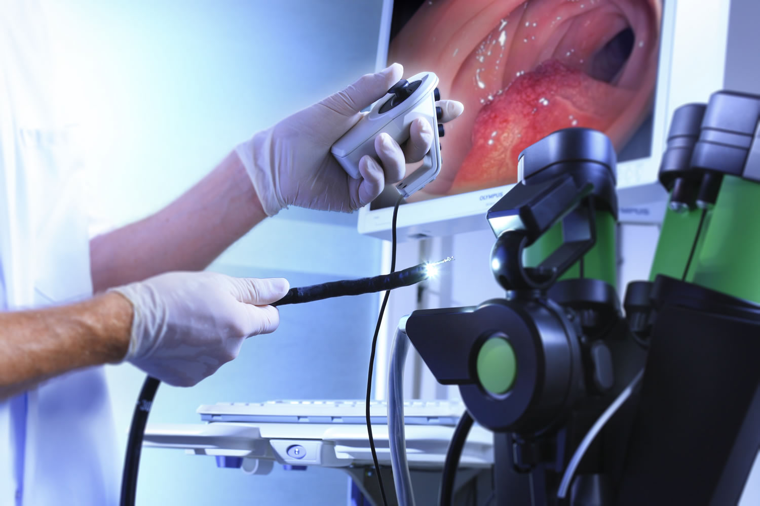 What To Expect For An Endoscopy at Marcus Corker blog