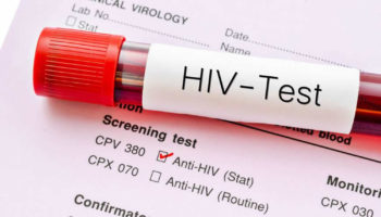 hiv test