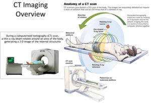 CT Scan - CAT Scan, Machine, Uses, Prep, Side Effects