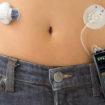 insulin_pump