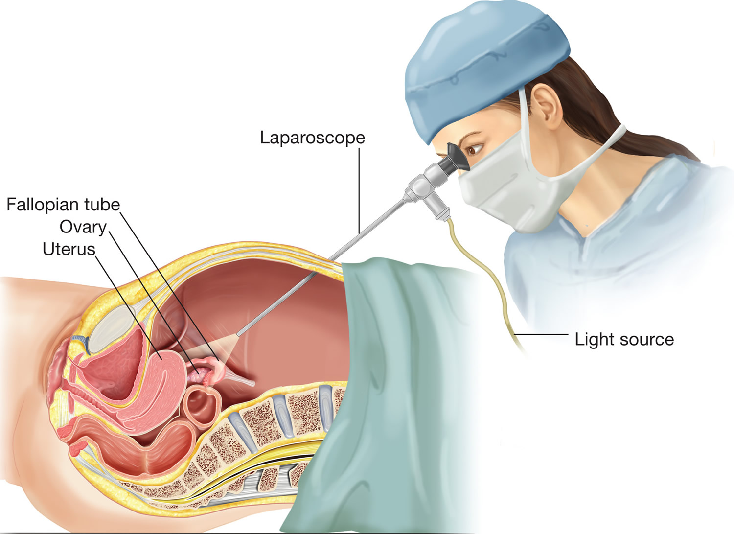 Laparoscopy Recovery Time And Laparoscopy Side Effects 8910