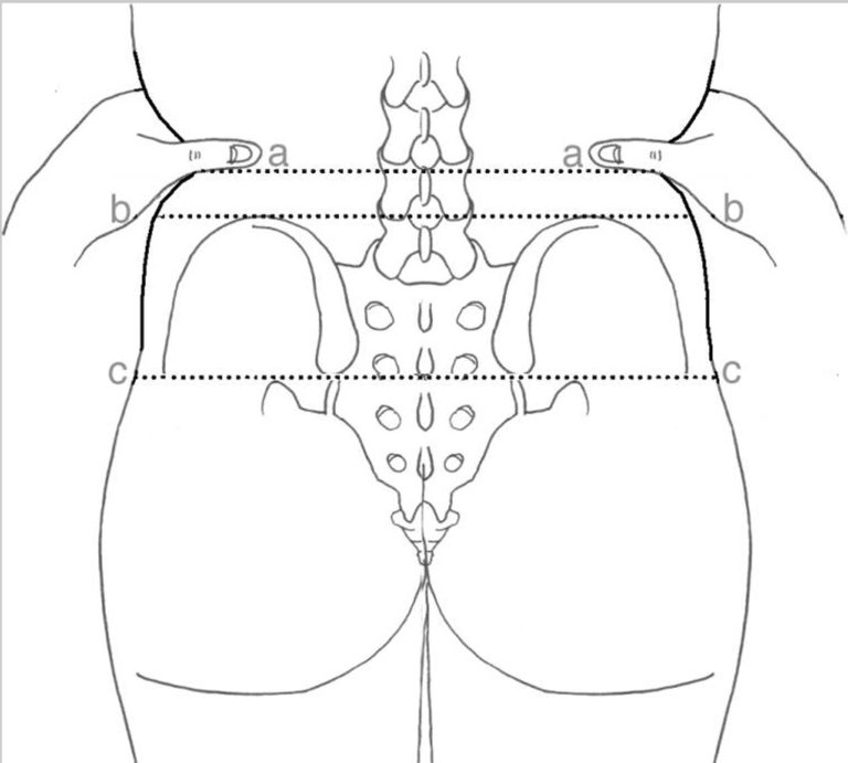 Lumbar Puncture Procedure Position And Lumbar Puncture Side Effects