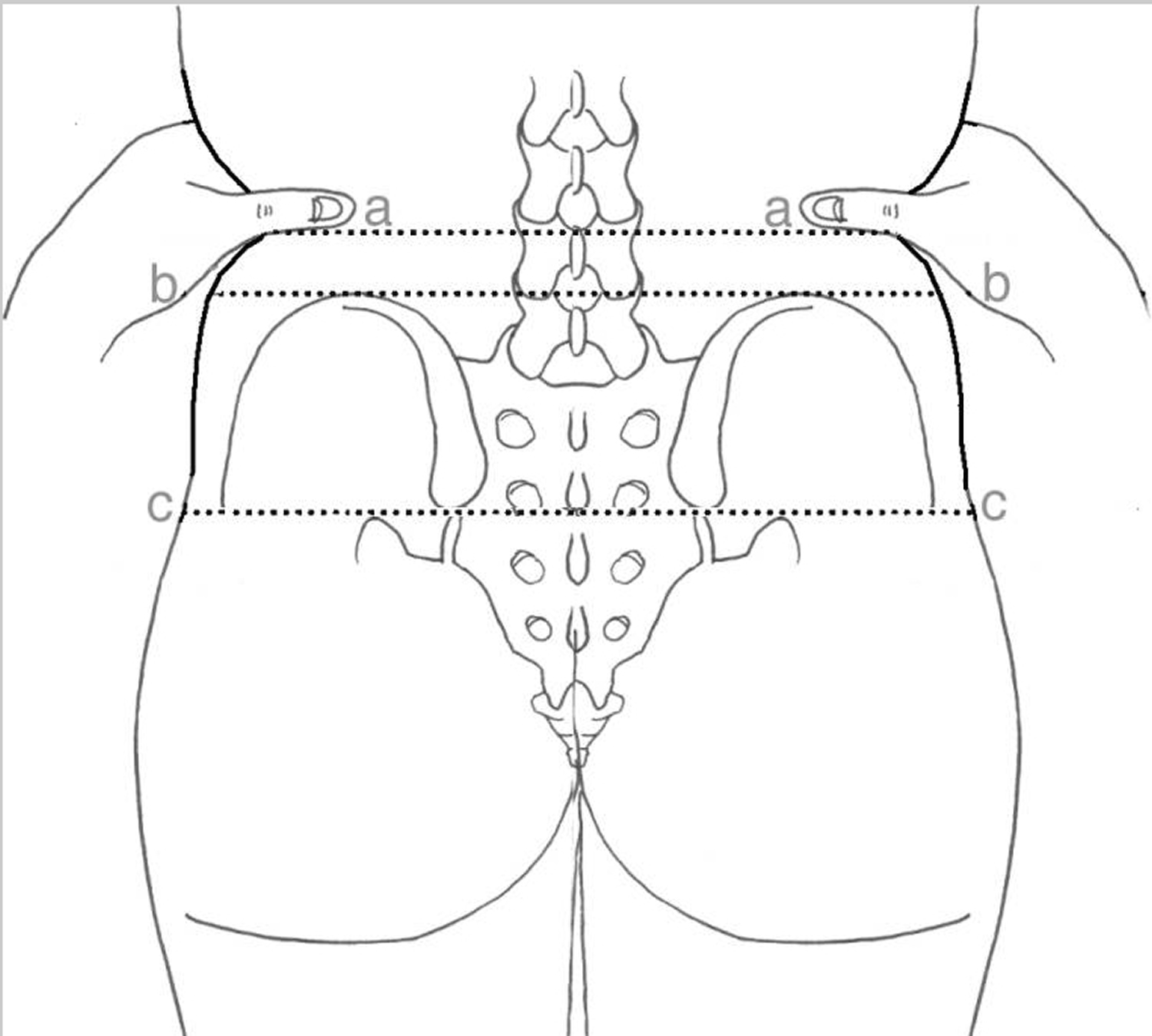 lumbar puncture position