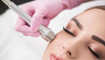 microdermabrasion