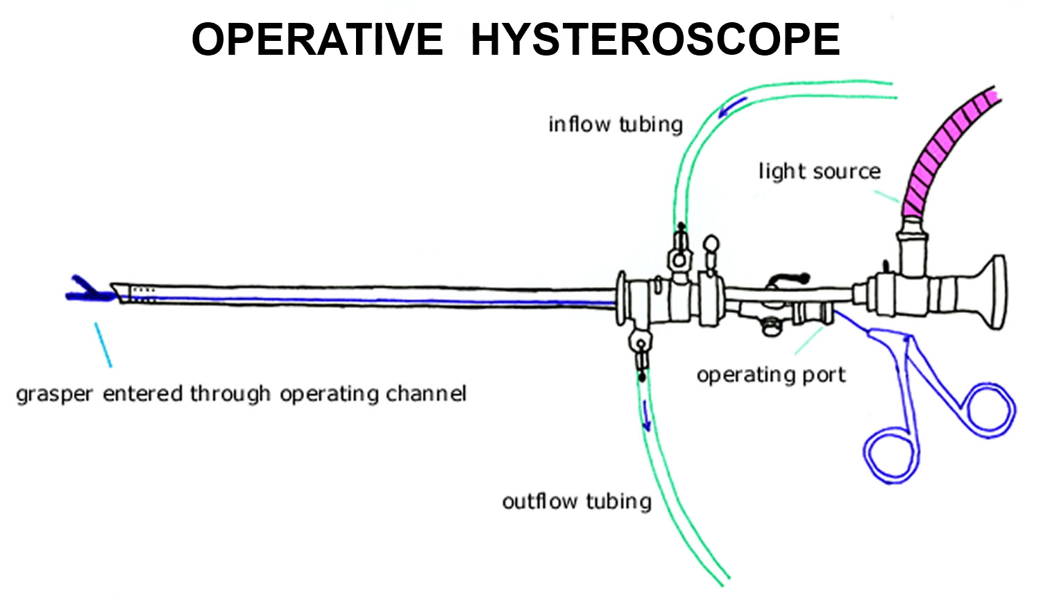 Laparoscopy Recovery Time And Laparoscopy Side Effects