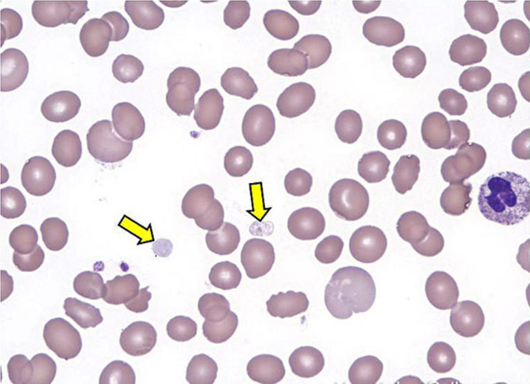 platelet-count-range-for-dogs