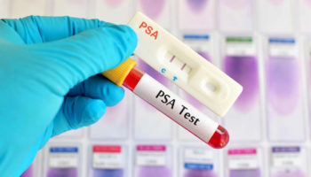 psa test
