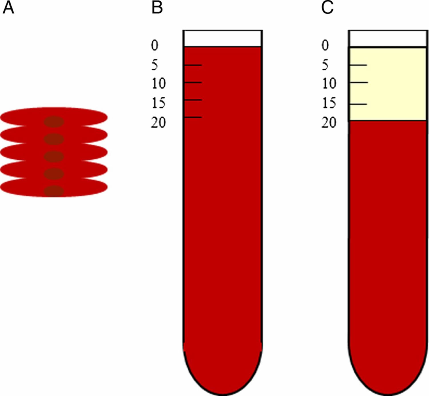 What Is Average Sed Rate