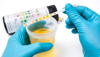 urinalysis
