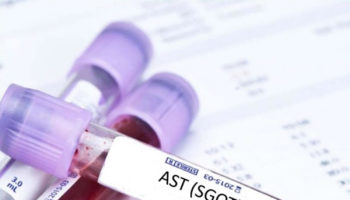 AST test