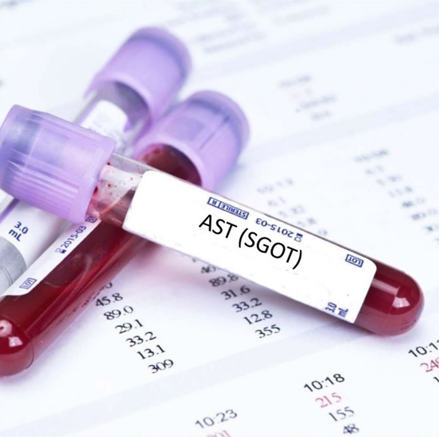 AST SGOT Blood Test Normal Range Causes Of High AST