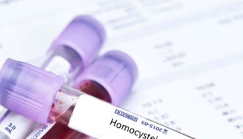 Homocysteine test