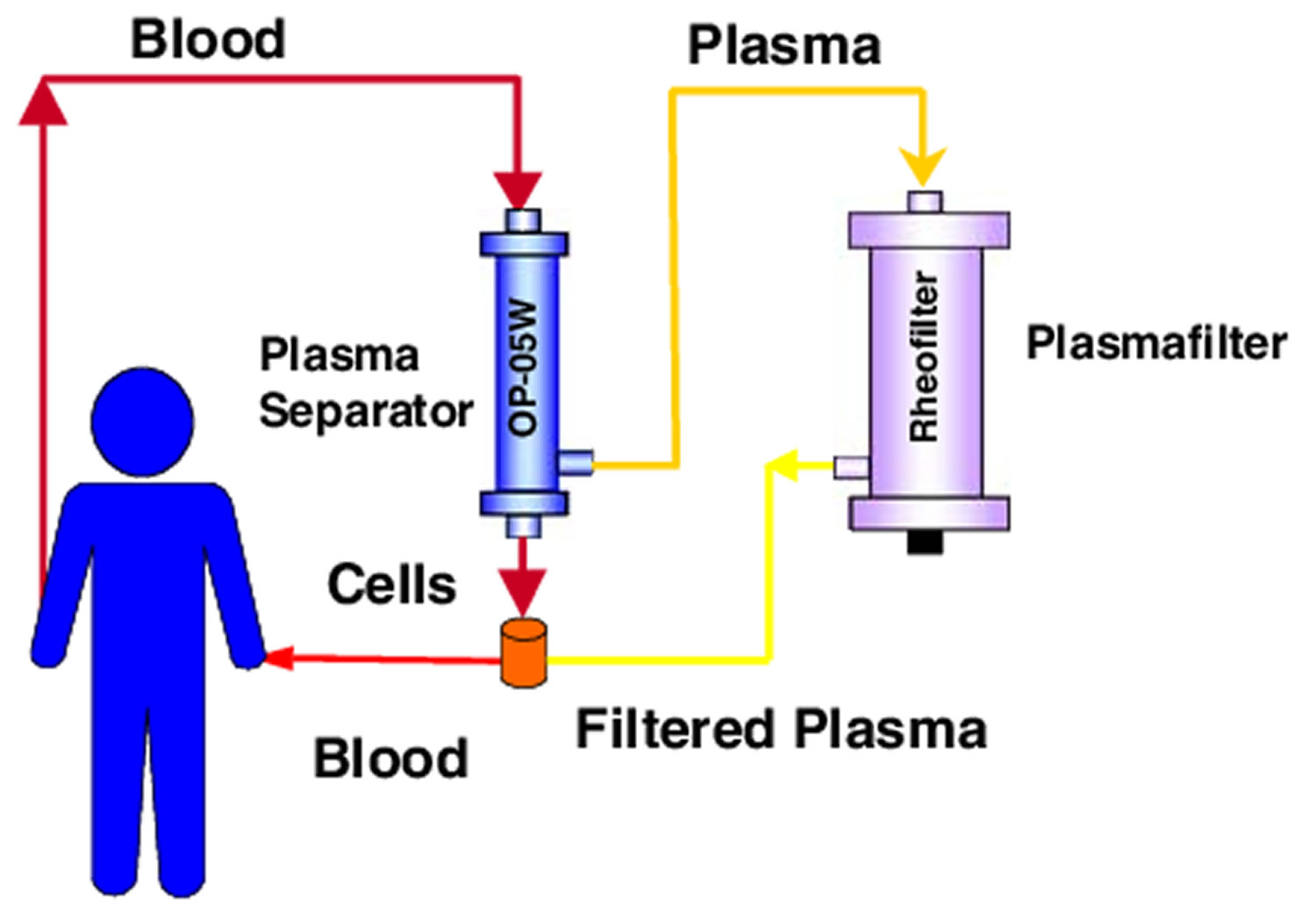 plasmapheresis procedure