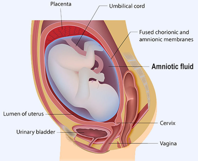 Amniotic Fluid Excess, Low, and Leaking Amniotic Fluid