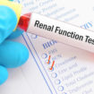kidney function test