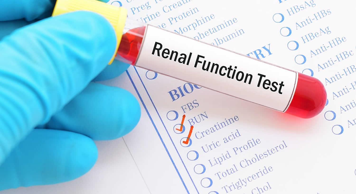 What Causes High Kidney Function Test Results