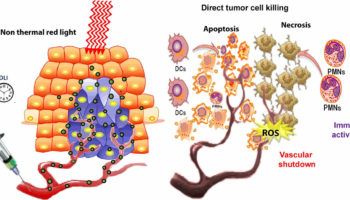 photodynamic therapy