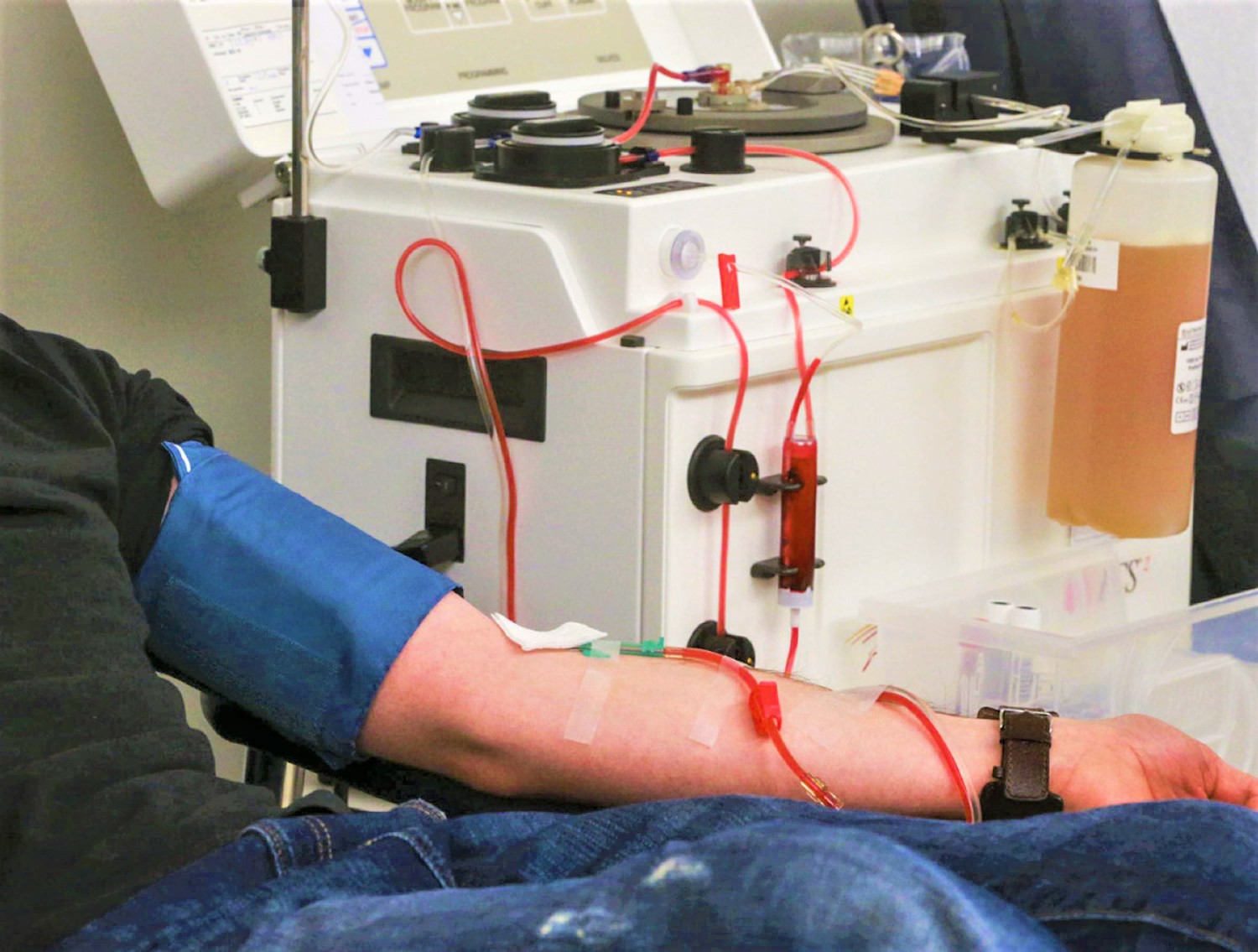 Plasmapheresis - Indications, Plasmapheresis Side Effects