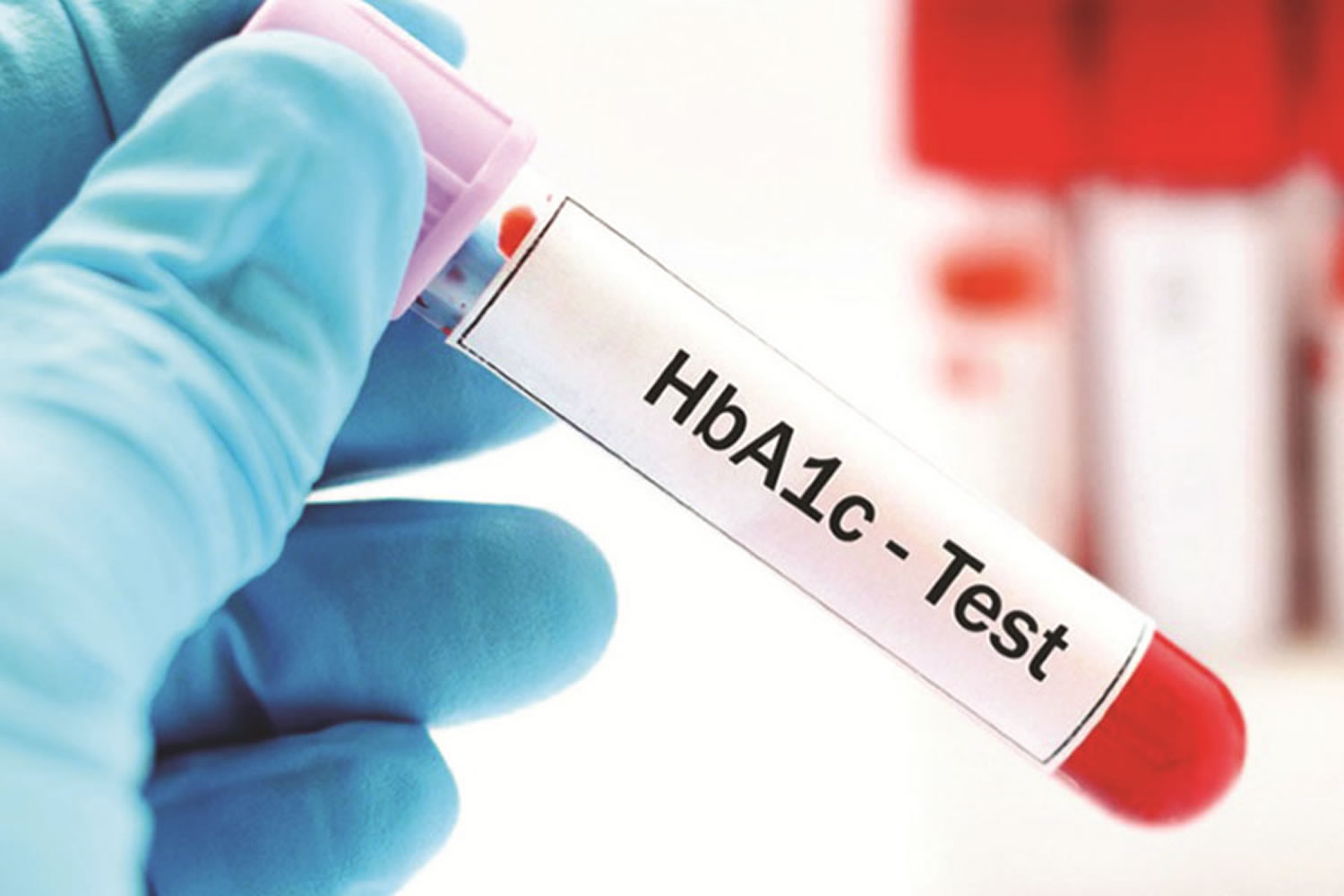 HbA1c Chart HbA1c Test Normal HbA1c Level And HbA1c Range Diabetes