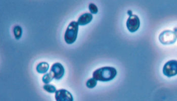 Saccharomyces cerevisiae