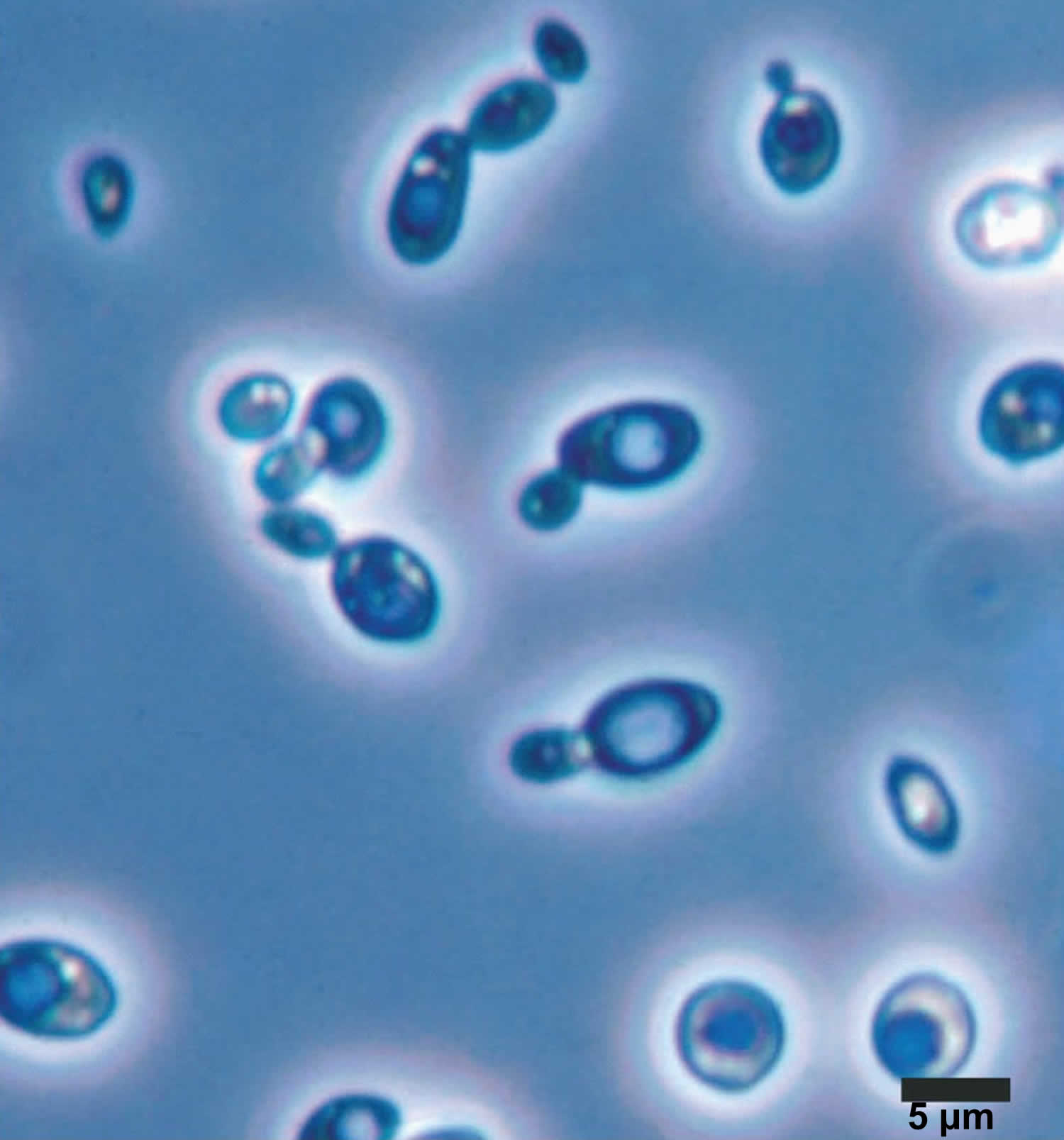 Saccharomyces-cerevisiae.jpg