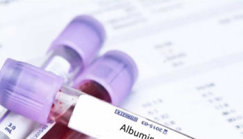 albumin