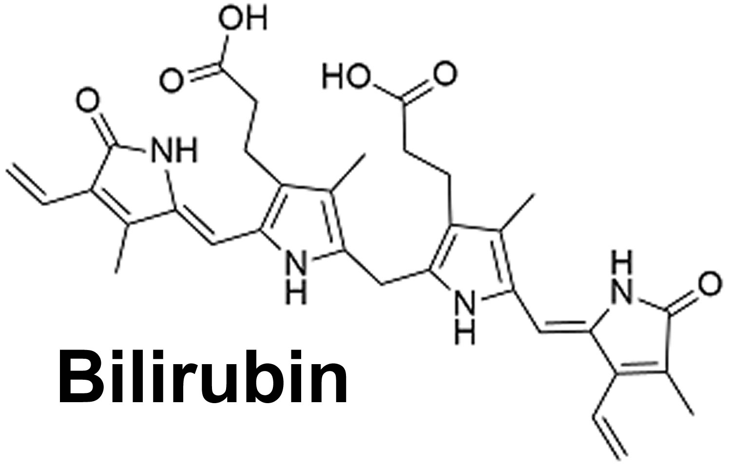 Bilirubin types, bilirubin levels chart and causes of high bilirubin levels