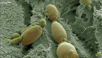 saccharomyces boulardii