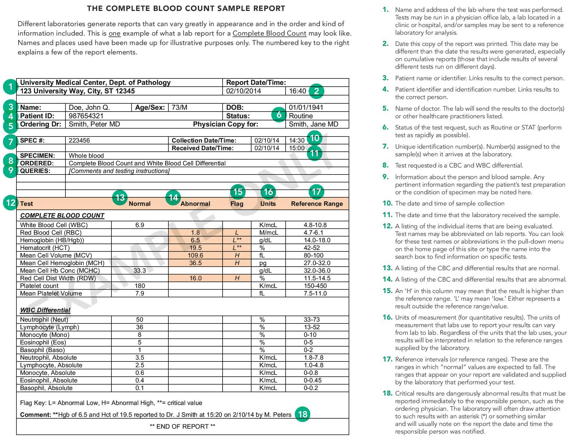 CBC test, complete blood count, cbc test results & normal complete ...