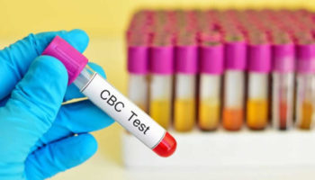 cbc test