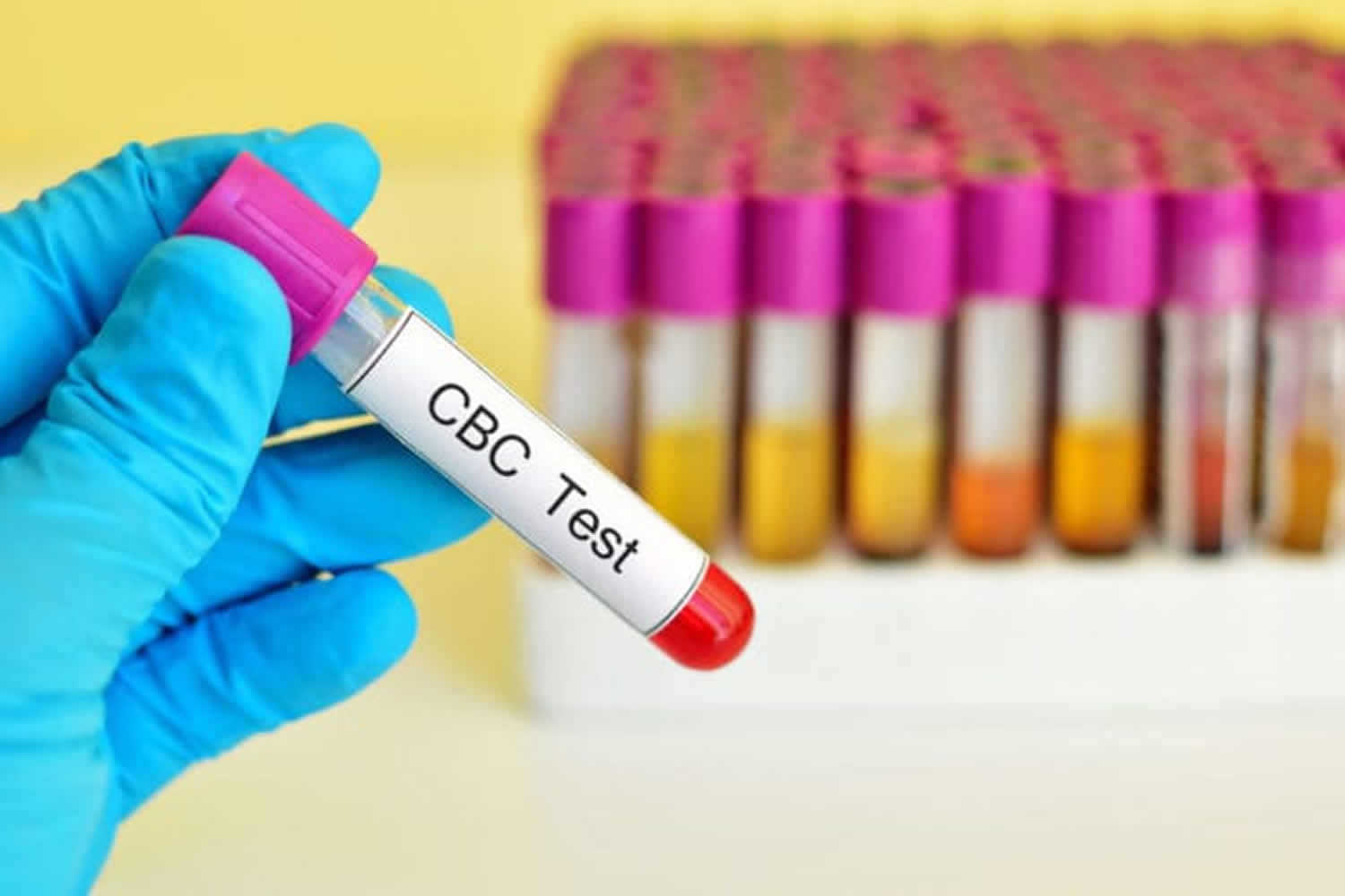 cbc blood test results